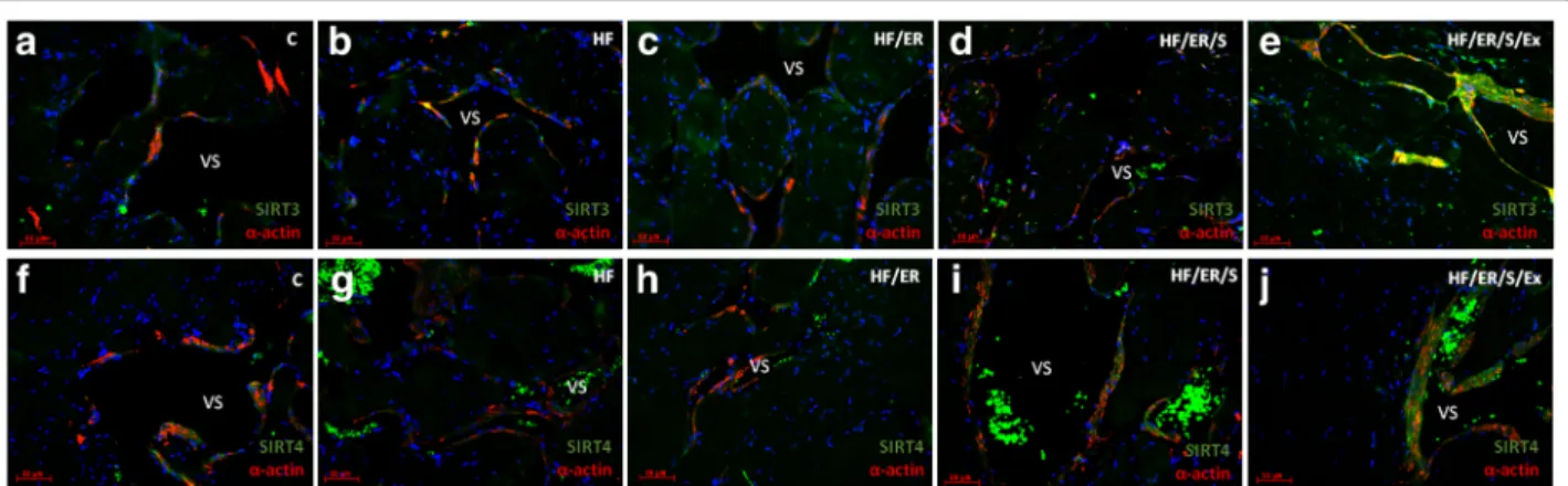 Fig. 3 Dual immunolabeling of SIRT3/ α -actin (a-e) and SIRT4/ α -actin (f-j) in erectile tissue of rats from experimental groups ( n = 3/group)