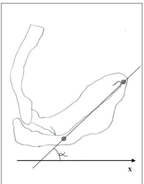FIGURA 4 - Rotação interna da escápula. 