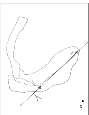FIGURE 2 – Internal rotation of the scapula. 