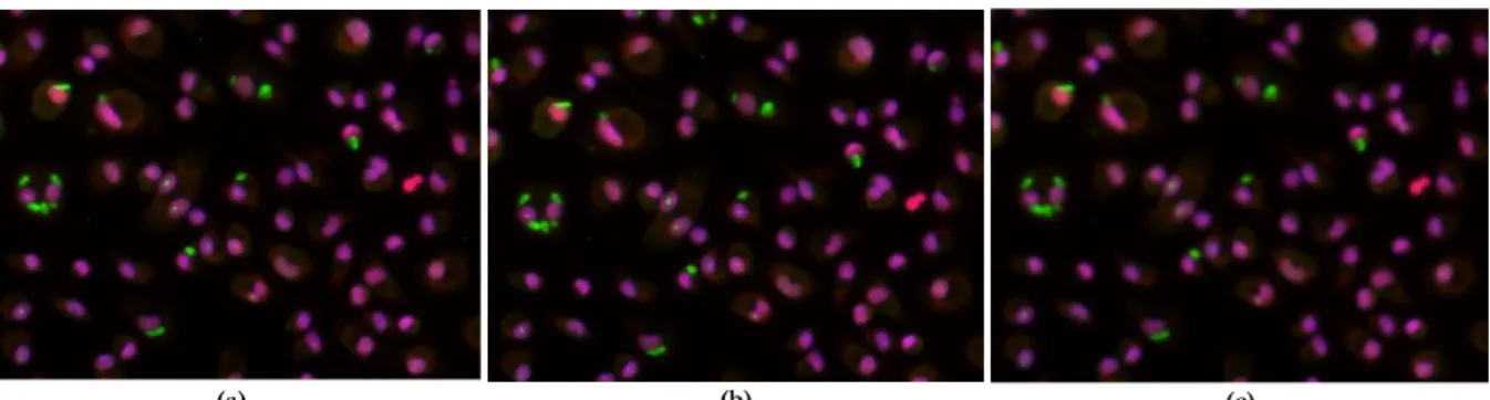 Figure 3.1: Illustration of a Gaussian and median filters implementation in Leishmania infected images: (a) Original Image; (b)  Gaussian filter implementation; (c) Median filter implementation