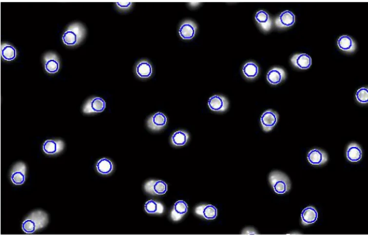 Figure 3.5: Hough Transform detecting circles in a Leishmania infected image. 