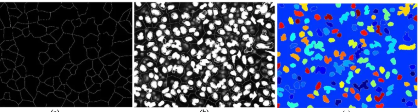 Figure 3.8: Illustration of the watershed segmentation in Leishmania Infected images: a) Watershed ridge lines; b) Markers and  object superimposed on original image; c) Color watershed label matrix