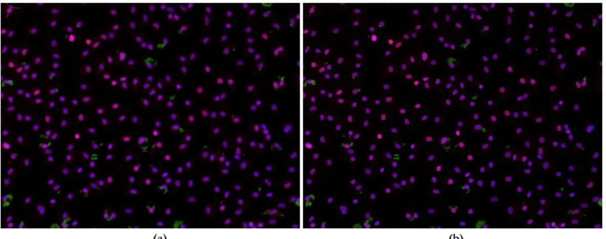 Figure  3.10:  Illustration  of  the  Mean-Shift  segmentation  in  Leishmania  Infected  images:  a)  Original  Image;  b)  Mean-Shift  implementation