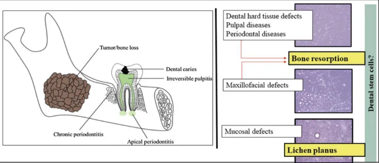 Figura 6: Defeitos dos tecidos orais e maxilofaciais. Adaptado de (Mendi et al., 2019) 