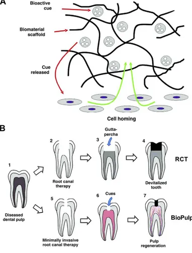 Figura  7:  Representação  da  técnica  homing  celular  para  regeneração  pulpar.  (A)  Os  sinais  bioativos incorporados em scaffolds libertam-se e atraem as células estaminais vizinhas para essa região
