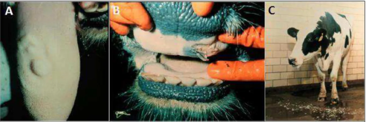 Figura 5. Sinais clínicos de estomatite vesicular. (A) Vesículas na língua de um bovino infectado com 