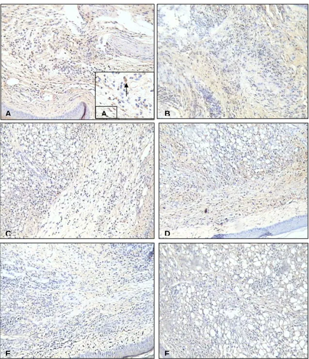 Figura 2. Expressão de iNOS  nas lesões de camundongos das linhagens C57BL/6 (A, C, E) 