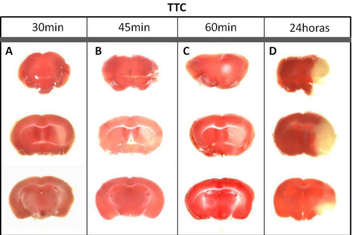 Figura 7: Imagens de fatias cerebrais (marcação com TTC) de animais submetidos a diferentes  tempos de isquemia