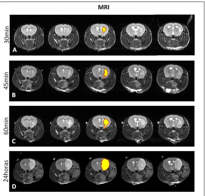 Figura 8: Imagens de ressonância magnética do cérebro de animais  submetidos a diferentes  tempos de isquemia