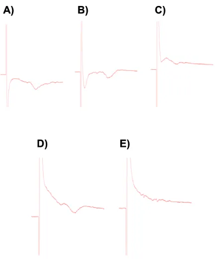 Figura 6: Registro do primeiro potencial de  campo obtido. (A) Sinal estável. (B) Inversão da  polaridade do estímulo