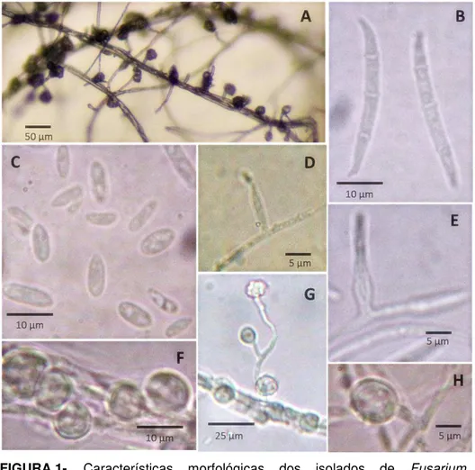 FIGURA 1-  Características  morfológicas  dos  isolados  de  Fusarium     oxysporum obtidos de grão-de-bico:  