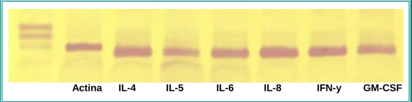FIGURA 4 .  Fotografia dos produtos da PCR analisados por eletroforese em gel de  poliacrilamida 8%corada pela prata.