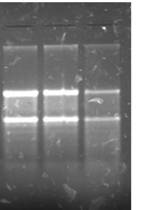 FIGURA 2 - Gel de agarose 1,0% corado com brometo  de etídeo evidenciando três amostras de RNA total  extraídos no estudo e com integridade preservada pela  análise da relação favorável entre as bandas  correspondentes aos RNAs ribossomais 28S e 18S