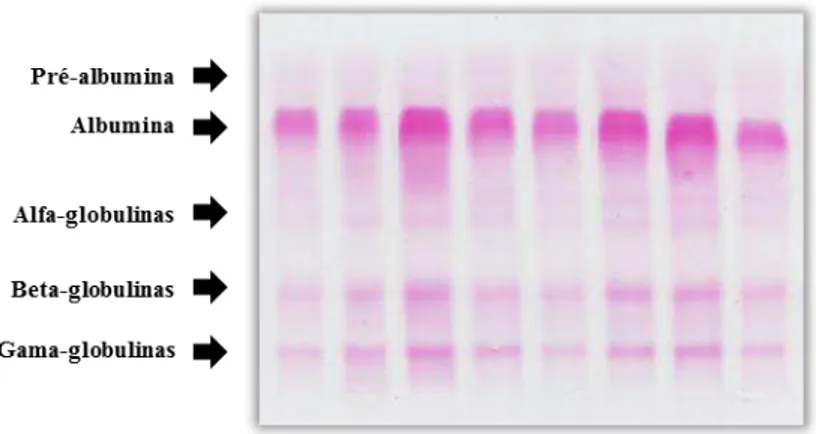 Figura  6.  Corrida  eletroforética  (gel  de  agarose,  coloração  Ponceau)  de  surubins  híbridos  (Pseudoplatystoma spp.)