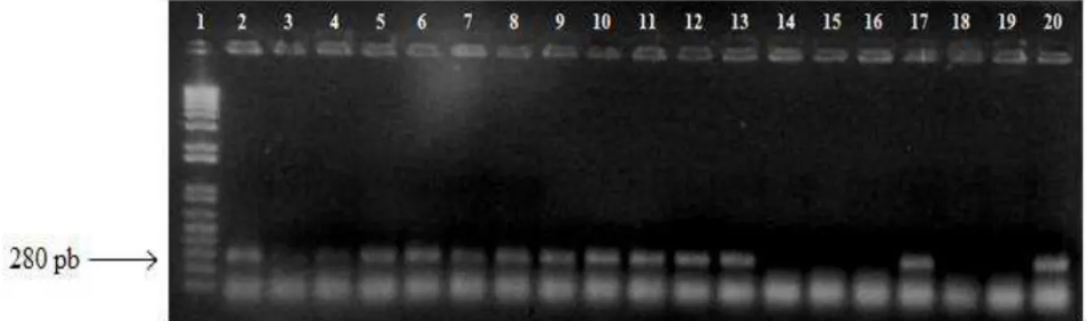 Figura 2. Gel de agarose 1,5% apresentando a amplificação do gene intI. 1. Marcador de  peso molecular 1kb (invitrogen, EUA), 2-18