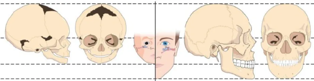 Figura 1 - Crânio de um recém- nascido vs Crânio de um adulto - Adaptado de Morin, Dorion, Moutquin, &amp; Levasseur (2012) 