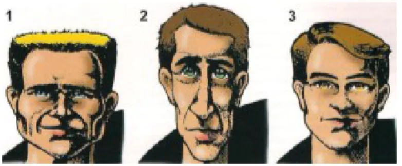 Figura  5  -  Diferentes  Biótipos  faciais:  1)Braquifacial;  2)  Dolicofacial;  3)  Mesofacial  (https://ortodontiauniville.blogspot.com/2017/09/?view=snapshot)