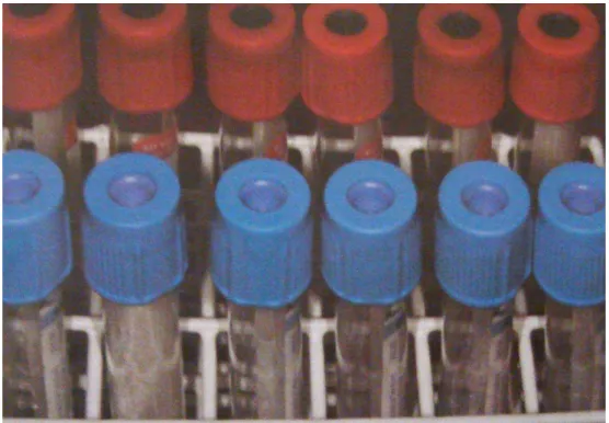 FIGURA 4 - Tubos com citrato de sódio (tampa azul) e vazios (tampa vermelha),  organizados em engradado próprio 