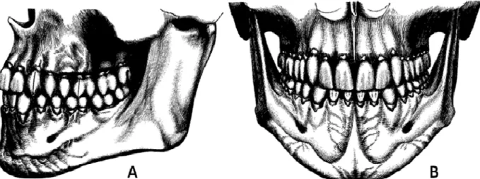 Figura 1.  Esquema mostrando a oclusão normal.  A. Vista lateral apresentando o posicionamento do  primeiro  molar