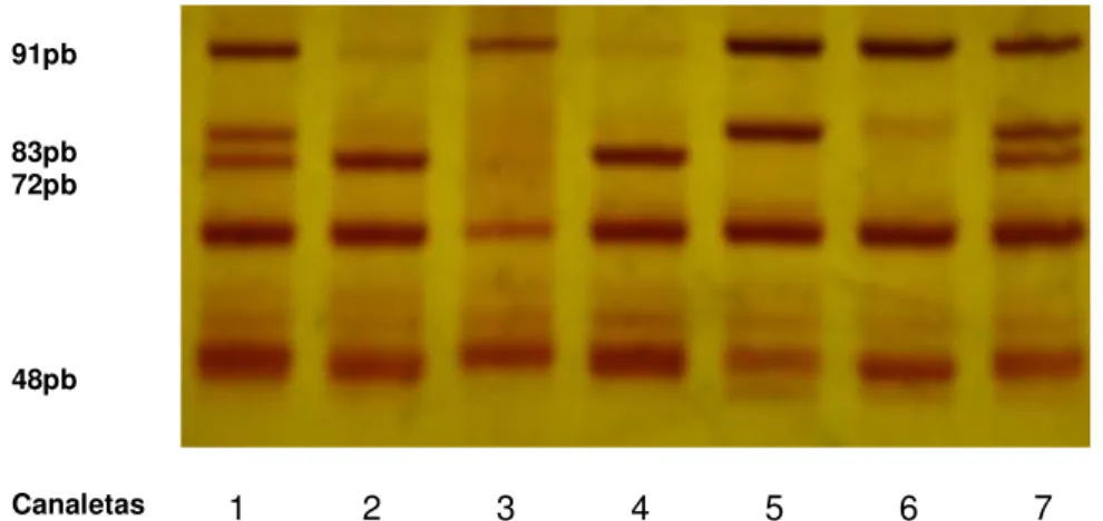 Figura 4 - Eletroforese, em gel de poliacrilamida a 12% corado pela prata,  dos produtos de PCR-RFLP do fragmento de 270pb do gene APOE
