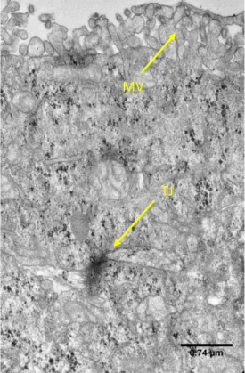 Figure  9-  Transversal  view  of  a  Caco-2  cell  cultured  for  7  days.  This  image  was  obtained  through  Transmission Electron Microscopy