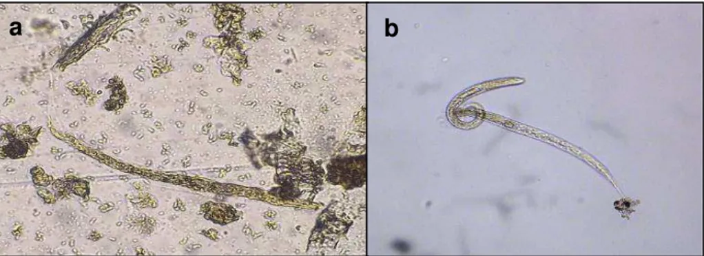 FIGURA  2  –  Larvas  de  primeiro  estágio  (L1)  de  Haemonchus  contortus  provenientes de ovinos (Objetiva de 10X) 