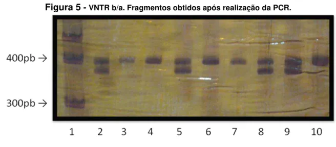 Figura 5  -  VNTR b/a. Fragmentos obtidos após realização da PCR. 