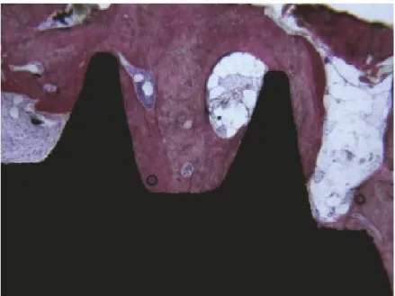 Figure 10: Osso compacto no terço médio e na porção apical está evidente. Não estão presentes gaps na  interface