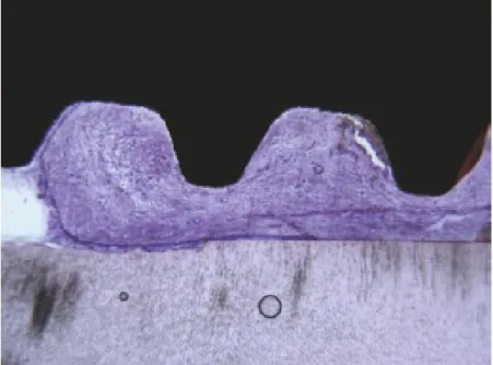 Figure 11: Na porção coronal, entre a raiz e o implante, está presente tecido conjuntivo sem inflamação