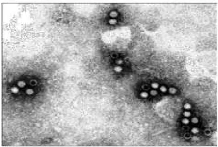 Figura 1 – Microscopia eletrônica de partícula de eritrovírus B19. Fonte:  Wadsworth Center, NYS Departament of Health