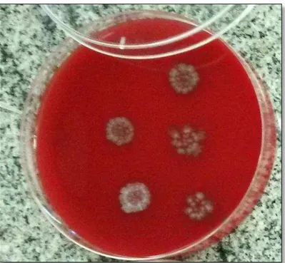 Figura  3.  Colônias  das  estirpes  não  toxigênicas  de  Clostridium  difficile  (NTCD)  em  ágar  sangue  suplementado  com  taurocolate  (AST)  se  apresentando  grandes,  branco-acinzentadas,  aspecto rugoso e bordas irregulares