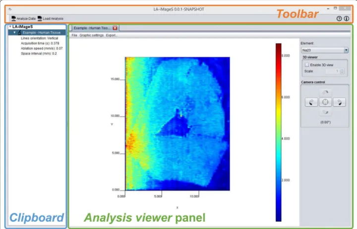 Fig. 3  LA‑iMageS graphical user interface (GUI) showing  23 Na +  distribution from a human tissue sample (Additional file 1)