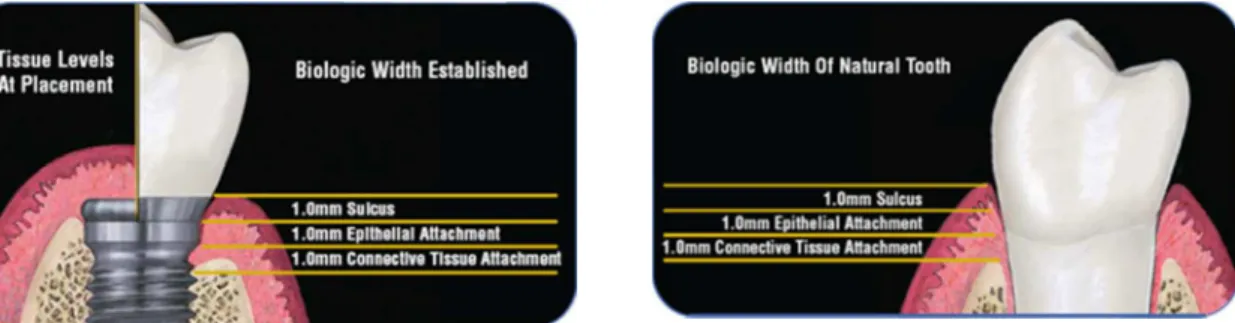 Figura  3-Espaço  Biológico  [Em  linha]  Disponível  em  ‹www.biomet  3i®.com.br›  [Consultado  em  15/06/2012]