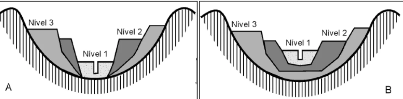 Figura 3: Representação esquemática dos níveis deposicionais embutidos (A) e integralmente embutidos (B)