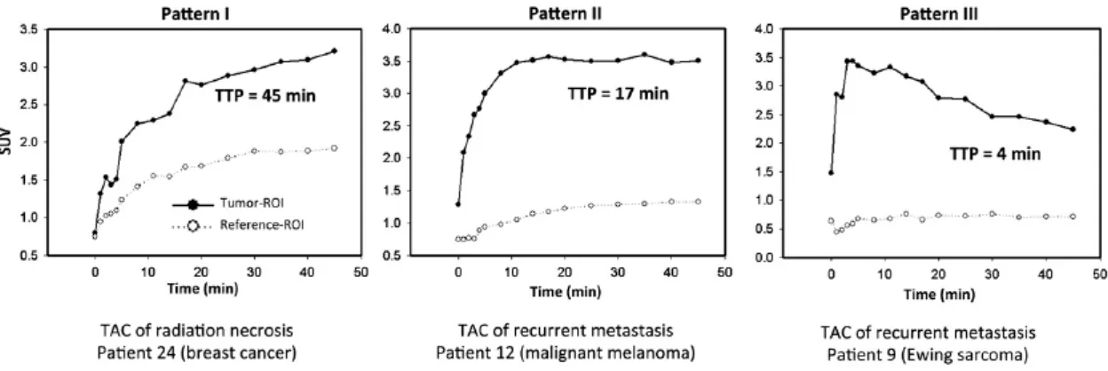 Figure  1.8  -  Examples  of  kinetics  of  radiation  necrosis  (pattern  I)  and  recurrent  brain  metastasis  (patterns  II  and  III)