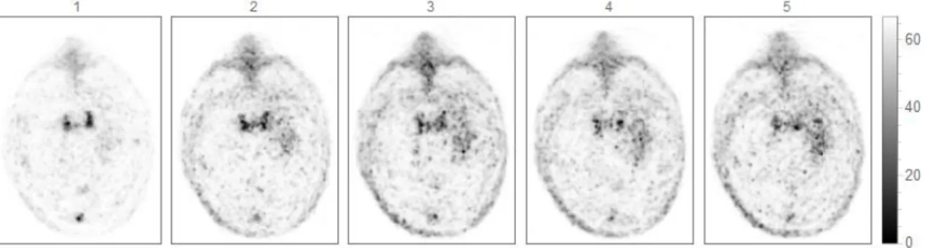 Figure 2.5 - First 5 frames of a dynamic FET PET scan (one minute each). 