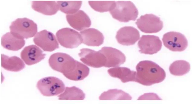 Fig 8. Amostras de sangue coradas com may-grunwald-giemsa mostrando 30% dos eritrócitos parasitados com Babesia  divergens