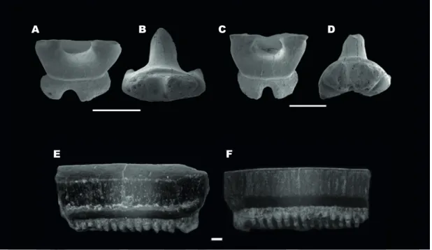 FIGURE 4. A, B) Mobula loupianensis anterior tooth (UEBR_11.1): A) occlusal and B) basal views