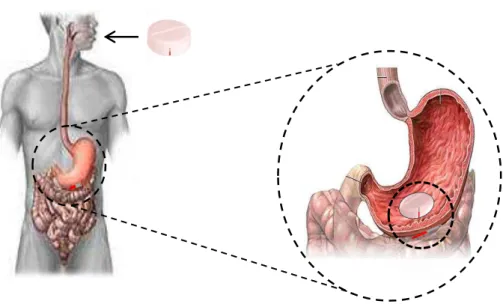 Figura 2 - Representação esquemática do mecanismo de ação de um comprimido magnético direcionado para o estômago