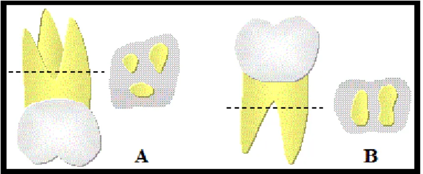 Figura 2: Zona de furca dos primeiros molares, (A) trifurcação primeiro molar superior,  (B) Bifurcação primeiro molar inferior, adaptada de: 