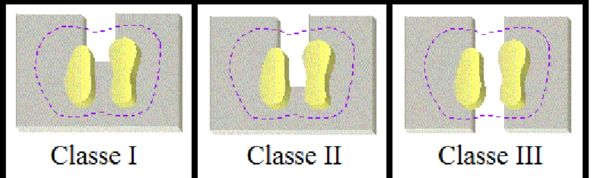 Figura 3: Classificação de Hamp adaptada de: 