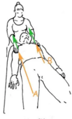 Figure 3 : Sollicitation manuelle des fascias grâce à une traction linéaire des tissus vers  le  haut  du  patient,  amenant  le  praticien  à  repérer  des  zones  de  tension  situées  à  distance (A et B). (Dessin : Myriam Valet, www.anat‐art.fr) 