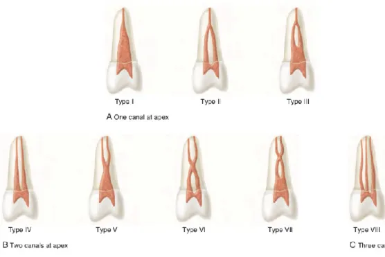 Figura 1 – Classificação de Vertucci (1974)  (Adaptado de Cohen’s, 2016) 