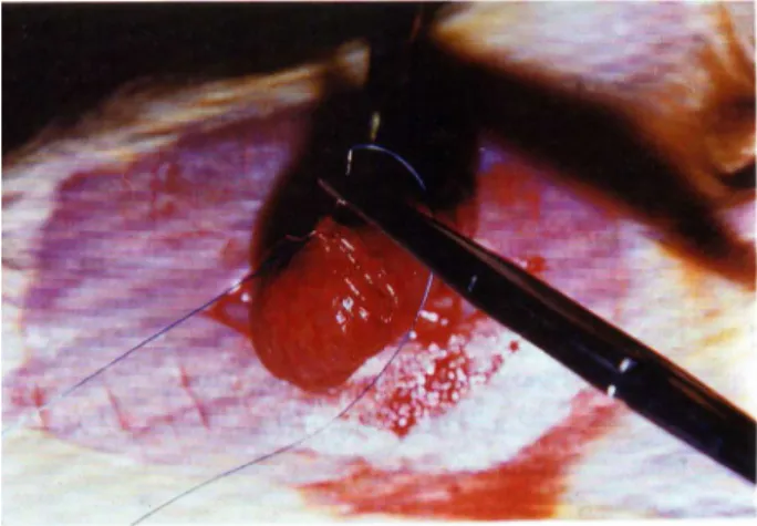 FIGURA 2 – Aspecto da sutura contínua da incisão do ceco em 