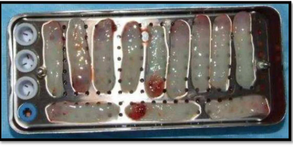 Figura  13  – Depois  da  compressão  na  caixa  de  PRF  são  obtidas  membranas  de  PRF  uniformes (M Del Corso et al