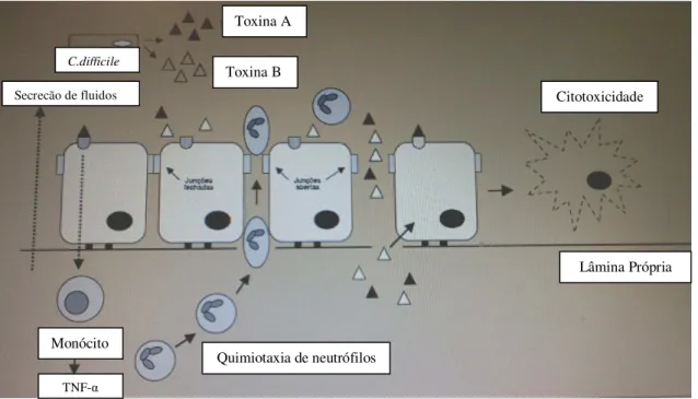 Figura 3: Ações das toxinas A e B do Clostridium difficile no epitélio intestinal (Silva e  Salvino, 2003) 