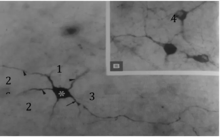 Fig.  2:  Fotomicrografia  evidenciando  um  corpo  celular  (1),  terminações  dendríticas  (2)  e  axónio  (3)