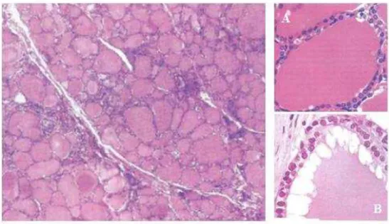 Figura 5. Corte histológico da glândula da tiróide. (A - Folículo tiroideu inativo; B - Folículo tiroideu ativo)