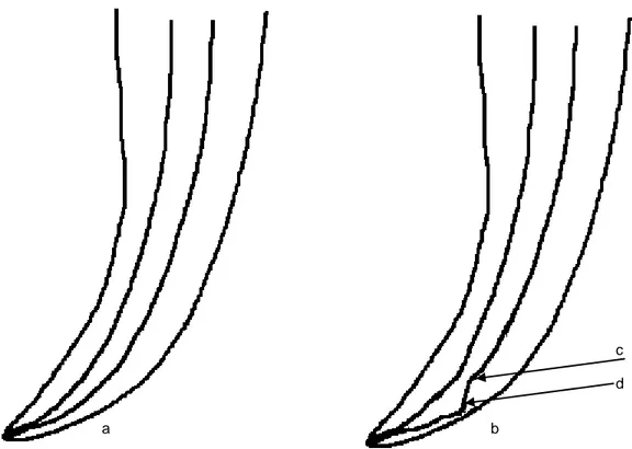 Fig. 3 - Esquematização de um zipping e elbow. Canal intacto (a) e com elbow  (c)e zipping (d) do canal assinalados com a seta (b)