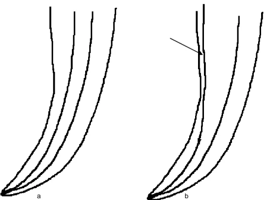 Fig. 4 - Esquematização de um stripping. Canal intacto (a) e com stripping do  canal assinalada com a seta (b)